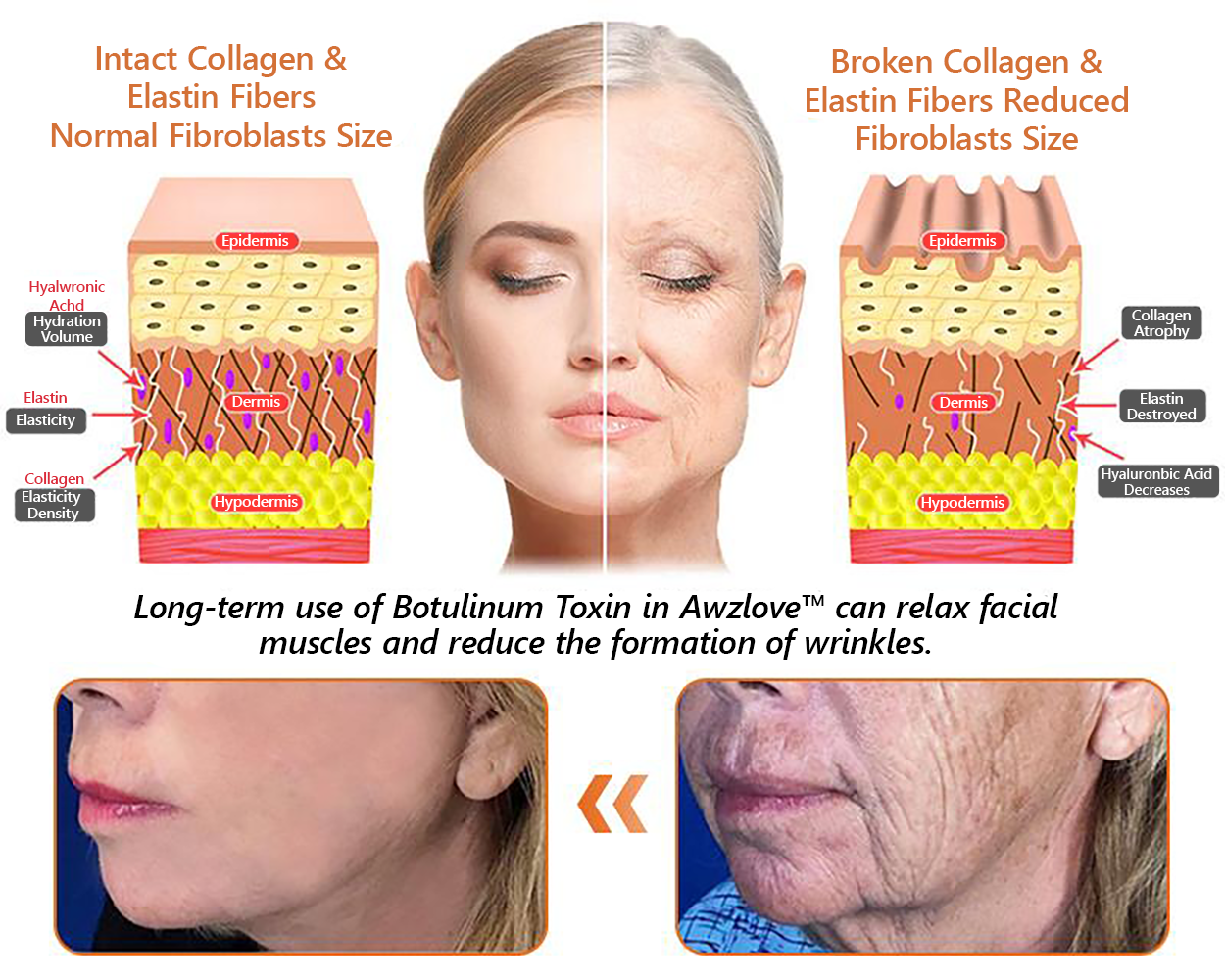 Sainishops™ AH-8 Bee Venom Firming Total-Lift Body Cream Clinically Tested by Dermatologists