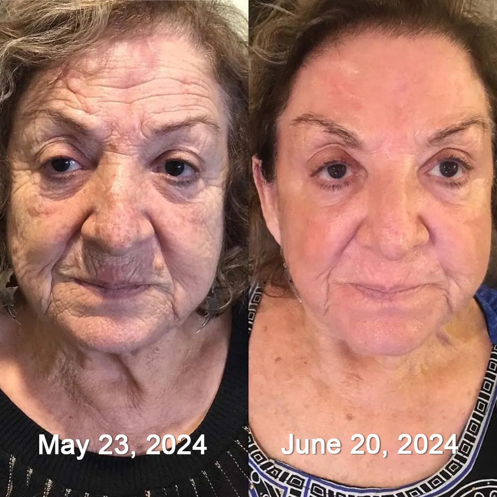 Sainishops™ AH-8 Bee Venom Firming Total-Lift Body Cream Clinically Tested by Dermatologists